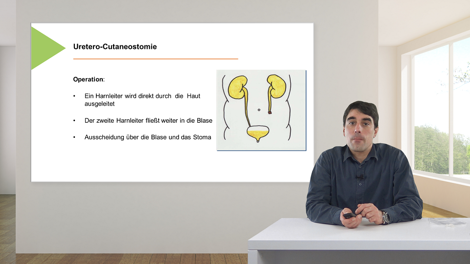Vorschaubild zum Kurs: Das Urostoma